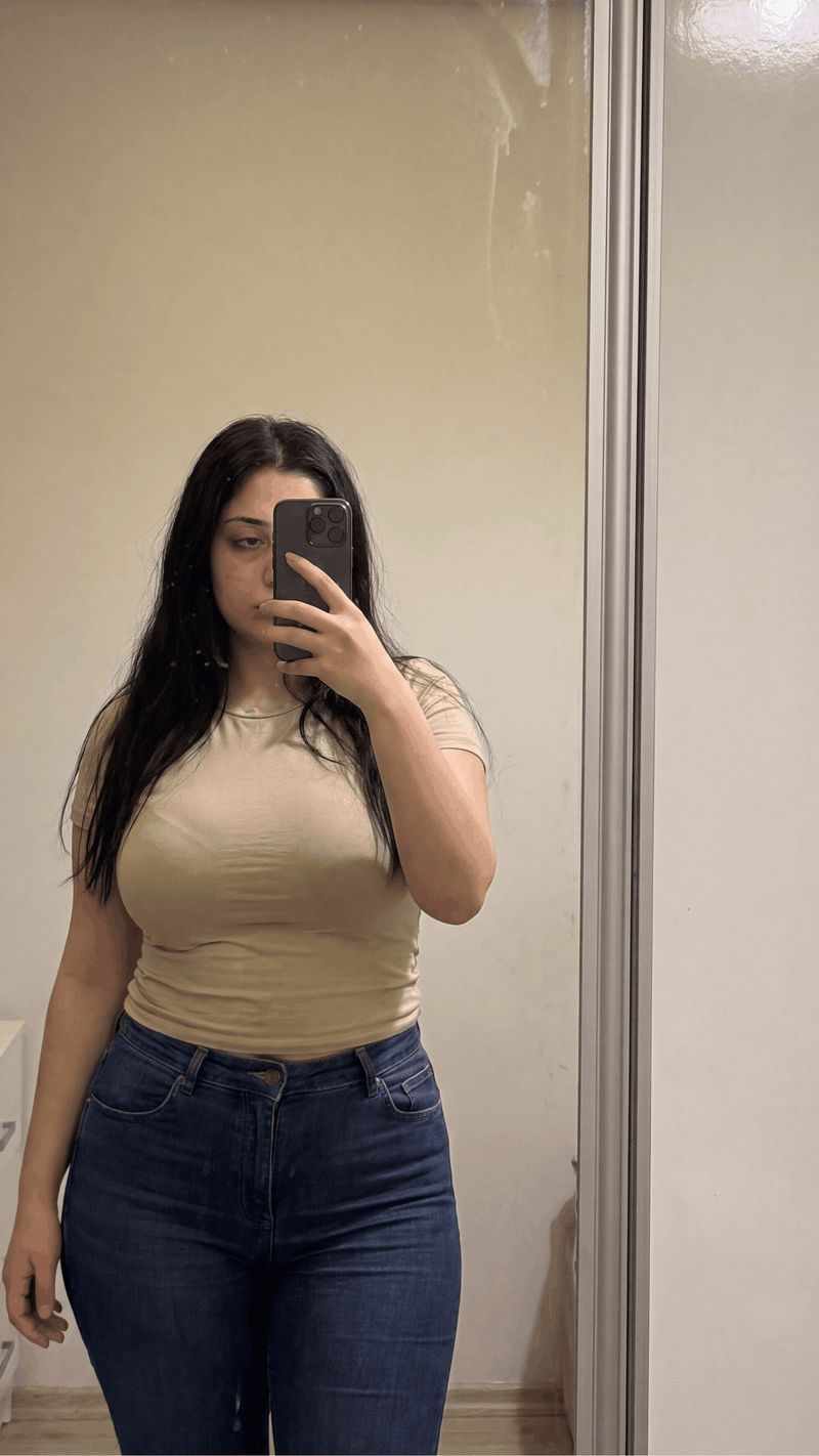 ELIF - 27 JAHRE Vorher